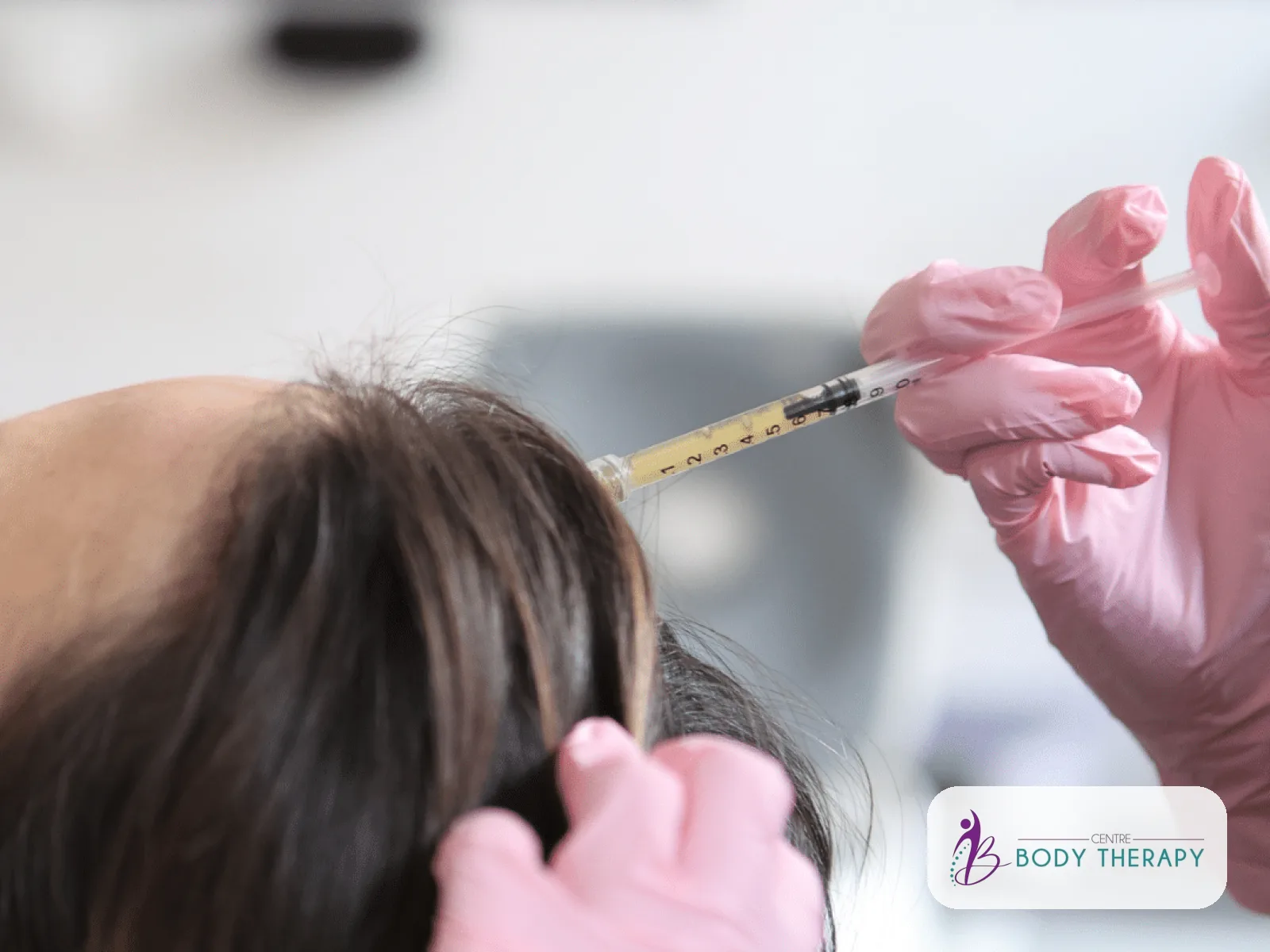 PRP anti-chute des cheveux